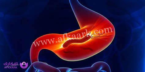 فوائد السريس لجرثومة المعدة وطريقة الاستخدام 4 فوائد السريس لجرثومة المعدة